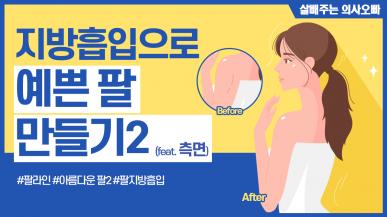 지방흡입으로 예쁜 팔 만들기 2 (feat. 측면)