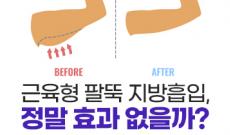근육형이면 팔뚝지방흡입 효과가 없나요?