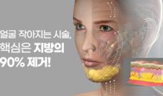 얼굴 작아지는 시술, 핵심은 지방의 90% 제거!
