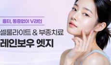 얼굴 셀룰라이트부터 지방흡입, 지방이식 부작용 치료까지 가능한 ‘레인보우 엣지’