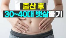 뱃살지방흡입 가격, 출산 후 30~40대 뱃살빼기