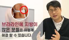 등살, 브라살도 지방흡입이 되나요? (브라라인 지방흡입)