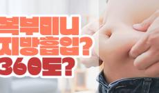 복부 미니 지방흡입 할까? 360도 할까?