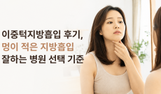 이중턱지방흡입 후기, 멍이 적은 지방흡입 잘하는 병원 선택 기준