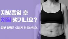 지방흡입 후 처짐 생기나요?