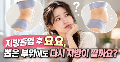 지방흡입 후 요요, 뽑은 부위에도 다시 지방이 찔까요?