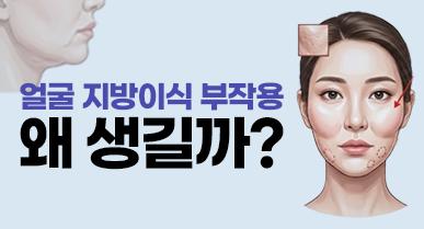얼굴 지방이식 부작용, 과생착부터 석회화, 처짐 해결 방법?