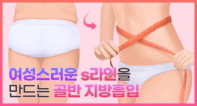 여성스러운 s라인을 만드는 골반 지방흡입