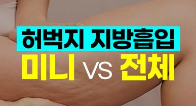 허벅지 미니 지방흡입 효과, 전체 지방흡입과 차이