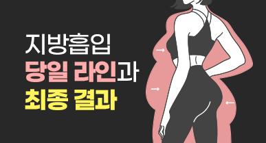 지방흡입 당일 라인과 최종 결과