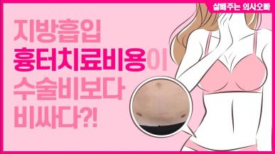 지방흡입 흉터 치료 비용과 방법
